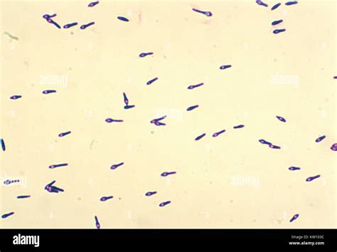 Clostridium botulinum fotografías e imágenes de alta resolución - Alamy