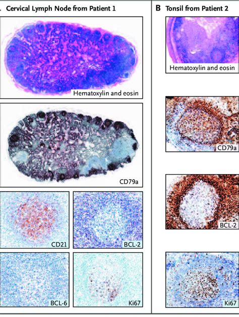 Germinal Center Lymph Node