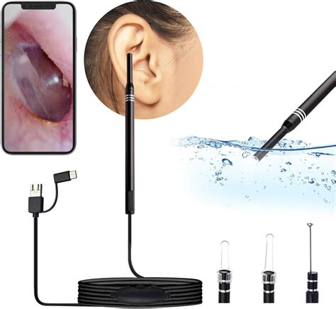 Amazon.com: Ear Camera Wax Removal Camera- WETDCQ Upgraded HD View Ear Scope Otoscope with Light ...