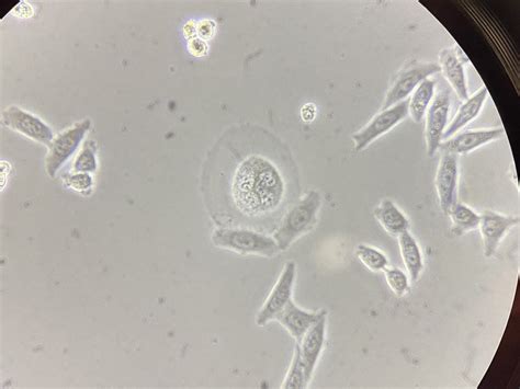 Have you ever observed this contamination in Hela cell? Is it fungal contamination or just un ...