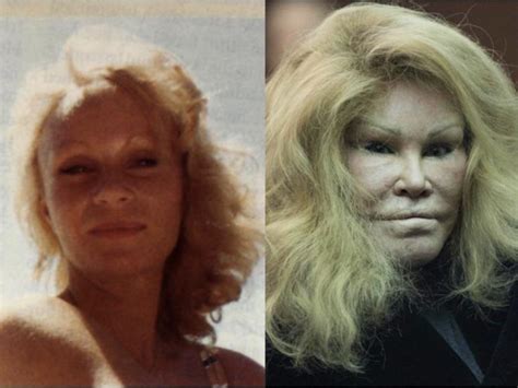 Billionaire NYC socialite Jocelyn Wildenstein (aka Catwoman) before and ...