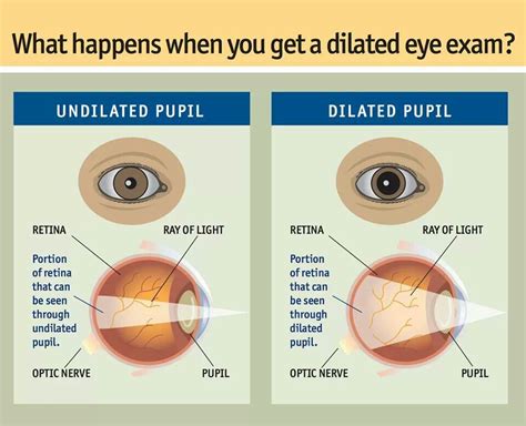 Undilated vs. Dilated pupil | Dilated pupils, Eye exam, Eye facts