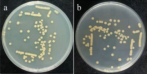 Colony morphology of Pseudomonas sp. Y-5 on LB agar medium. a Front of... | Download Scientific ...