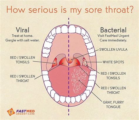 Sore Throat Ear Pain Headache Tired - Headache