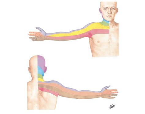 Dermatomes UE: Identify Quiz