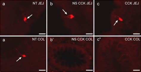 Examples of single labeling of enteroendocrine cells in the human... | Download Scientific Diagram