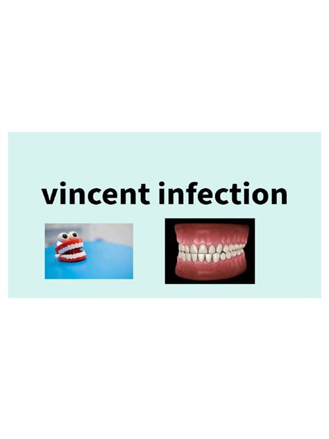 Vincent infection | PDF