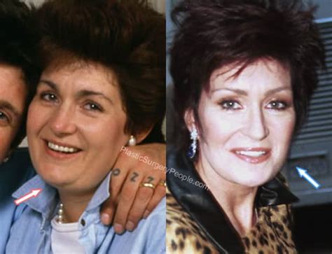 Sharon Osbourne: BEFORE and AFTER