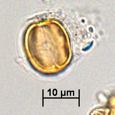 Flickriver: Photoset 'prolate to prolate-spherical, C3P3/C3P0, psilate-granulate types' by ...