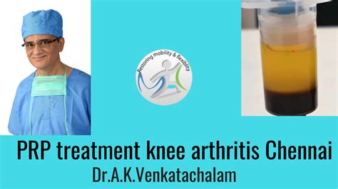 PRP therapy knee arthritis Chennai