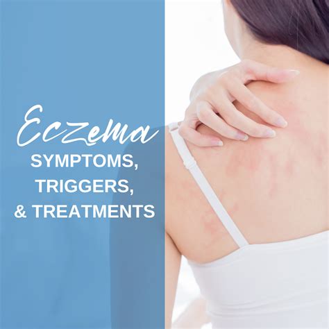 Eczema: Symptoms, Triggers, and Treatments