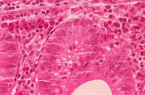 Basic Histology -- Mitotic Figures _ Here is another slide with a mitotic figure. This is ...