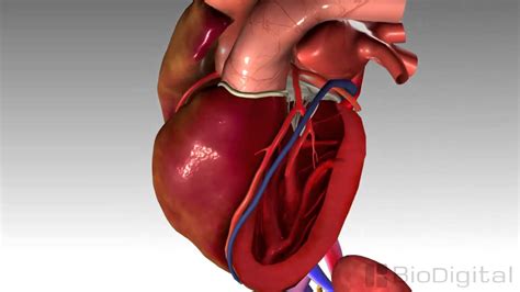 X 3D Medical Animation Congestive Heart Failure 2 - YouTube