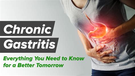 Chronic Gastritis : What Is It, Causes, Symptoms, Diagnosis, And More