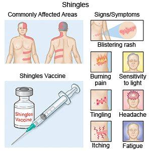 Shingles Rash On Neck