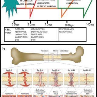 Timelines outlining successive stages in the processes of wound healing ...