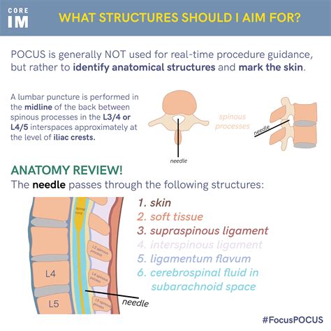 Lumbar Puncture Procedure Anatomy