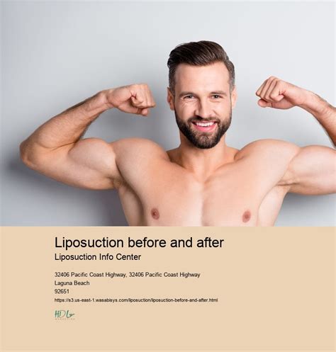 liposuction before and after