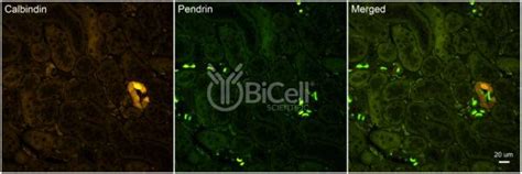 Calbindin-1 (CALB1 or Calbindin D-28K) antibody - BiCell Scientific®