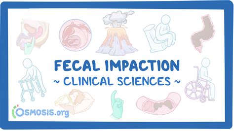 Fecal impaction: Video & Meaning | Osmosis