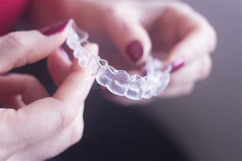 Clear Dental Teeth Retainers Stock Photo - Image of healthy, background ...