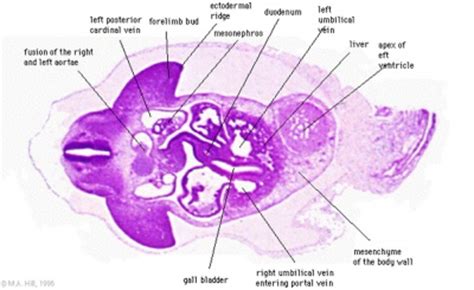 Lecture - Limb Development - Embryology