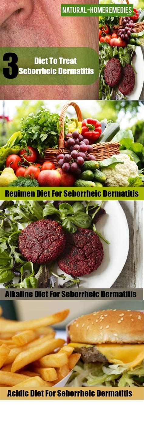 Diet To Treat Seborrheic Dermatitis | Seborrheic dermatitis, Acidic diet, Dermatitis