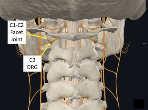 How Does the Body Stabilize the C1-C2 Joint? The Role of the Alar ...