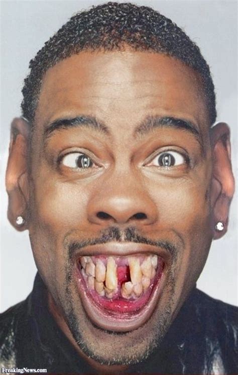 Celebrity Teeth – What They Looked Like Before & After! - Yahoo Image Search Results Crazy ...