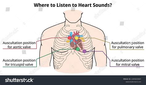 Where Listen Heart Sounds Auscultation Position Stock Vector (Royalty ...