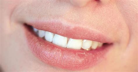 Itchy Lips: Symptoms, Causes & Home Remedies