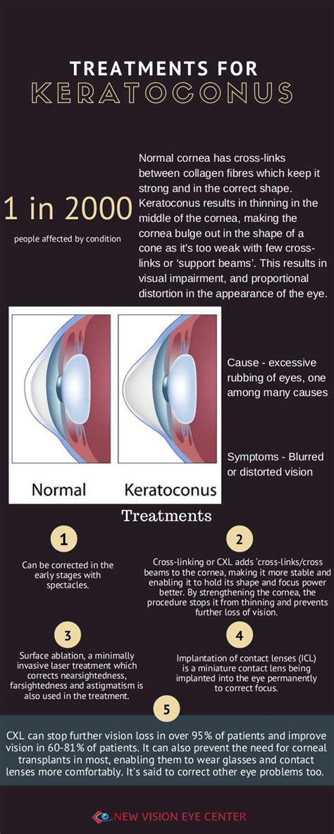 Treatments for Keratoconus