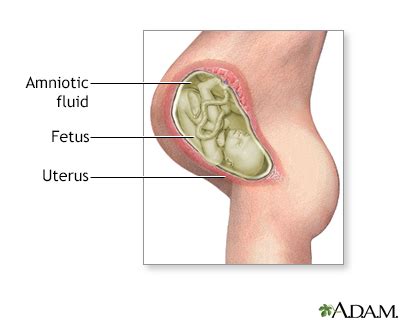 Amniotic fluid Information | Mount Sinai - New York