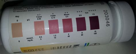 ketostix color chart Ketone ketostix strips urinalysis nz pharmacydirect - dietklanblakewood