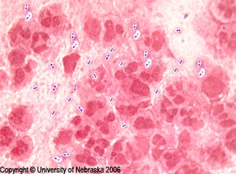 RBCs, WBCs, SECs in Gram Stains - Microbiology learning: The "why"ology ...