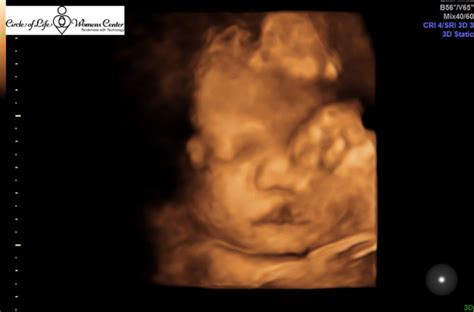 38 week 3D ultrasound... anyone have pics to share? Here is mine! - BabyCenter