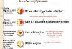 Acute Coronary Syndromes and Atypical Angina. | Acute coronary syndrome, Acute nursing, Nursing ...