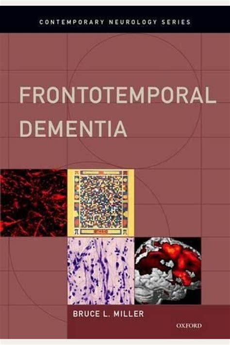 Buy Frontotemporal Dementia Book By: Bruce L Miller