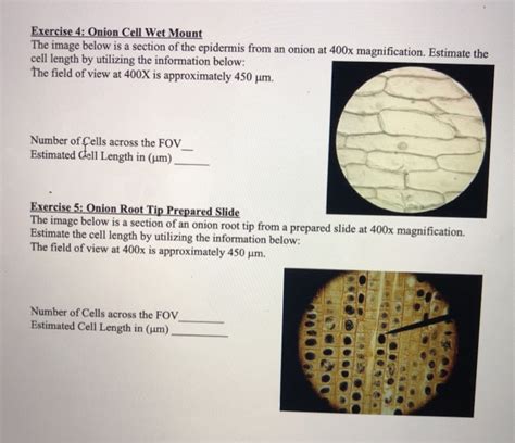 Solved Exercise 4: Onion Cell Wet Mount The image below is a | Chegg.com