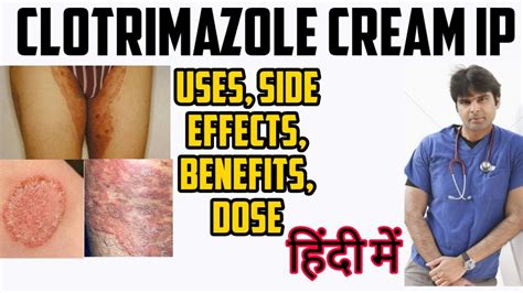 Clotrimazole Cream IP | Clotrimazole Cream Uses, Side effects, Dose ...