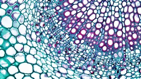 Angiosperm Morphology: Cambium in Midrib Vascular Bundle of Syringa | by bccoer Syringa ...