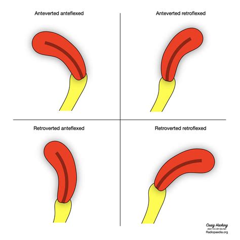 List 96+ Wallpaper Uterus Position During Pregnancy Pictures Latest