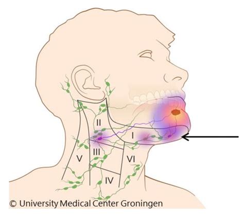 Lymph nodes location - devillader