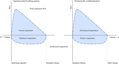 Interpretare la forma del ciclo flusso-volume | Li Linguas