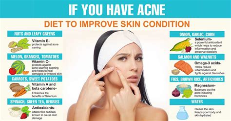 Foods That Kill Acne | VS MedSpa Skin and Laser Clinic