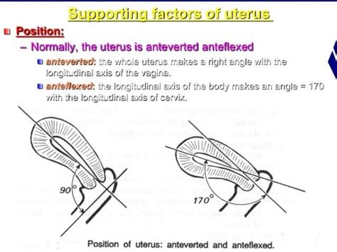 Retroverted retroflexed uterus &uterine inversion