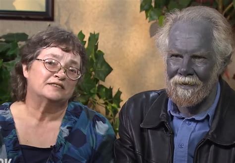 A Man Turned Blue After Years of Taking Dietary Supplements / Bright Side