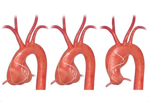 For the first time, a statistical relationship has been established between the shapes of ...