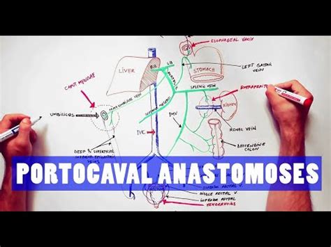 Portocaval Anastomoses - ANATOMY Tutorial - YouTube