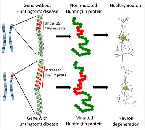 Huntington’s disease: how could stem cells help? | Eurostemcell